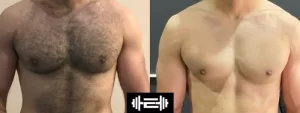 How to lose weight fast
